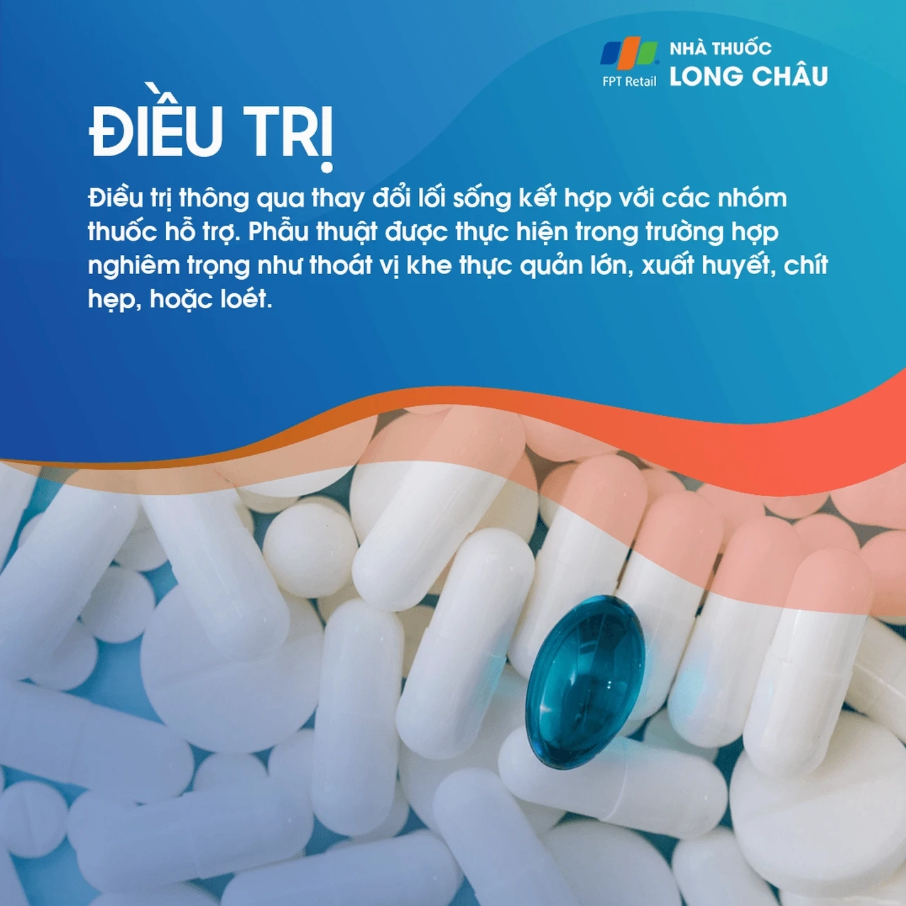 Tô màu thay đổi lối sống để điều trị trào ngược