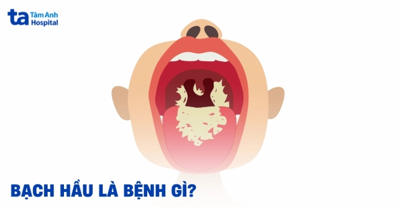 Tô màu vi khuẩn gây bệnh bị tiêu diệt