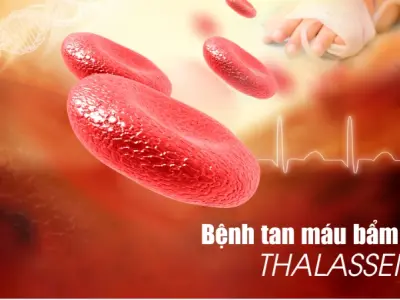 Tổng hợp hình ảnh bệnh tan máu bẩm sinh dễ nhận biết