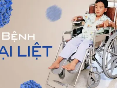Các dạng hình ảnh bệnh bại liệt phổ biến hiện nay