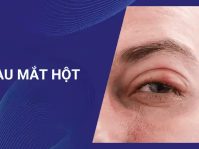 Dấu hiệu nhận biết sớm qua hình ảnh bệnh đau mắt hột