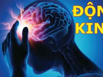 Xem ngay hình ảnh bệnh động kinh dễ nhận biết triệu chứng