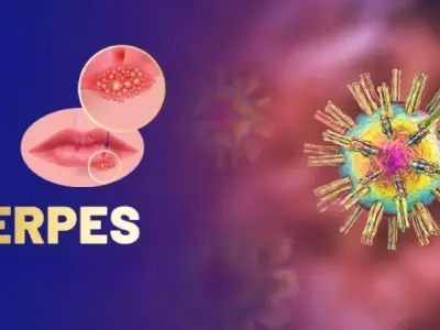 Cảnh báo dấu hiệu qua hình ảnh bệnh herpes thực tế