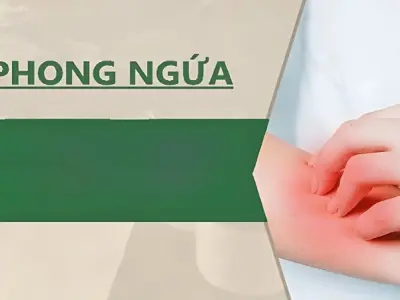 Tổng hợp hình ảnh bệnh phong ngứa phổ biến hiện nay