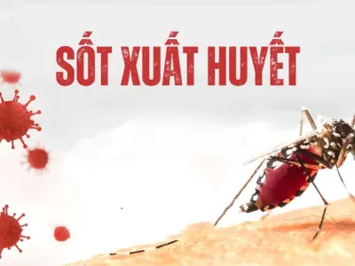 Nhận biết hình ảnh bệnh sốt xuất huyết ở người lớn