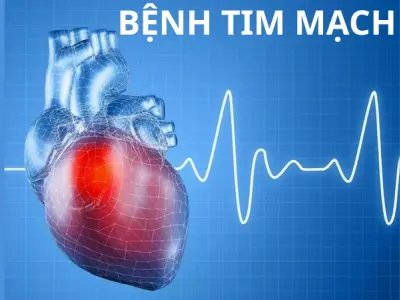 Tổng hợp hình ảnh bệnh tim mạch thường gặp hiện nay