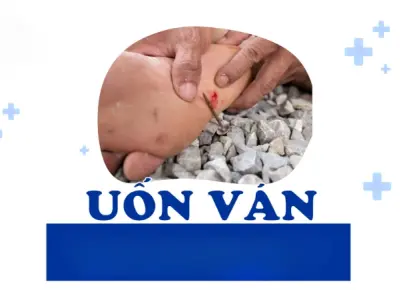 Tổng hợp hình ảnh bệnh uốn ván qua từng giai đoạn