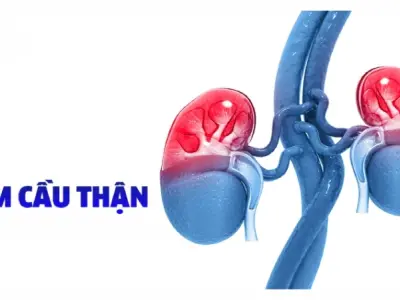 Nhận biết sớm qua hình ảnh bệnh viêm cầu thận thực tế