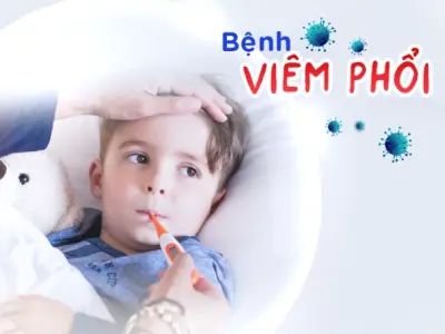 Hình ảnh bệnh viêm phổi giúp nhận biết dấu hiệu sớm