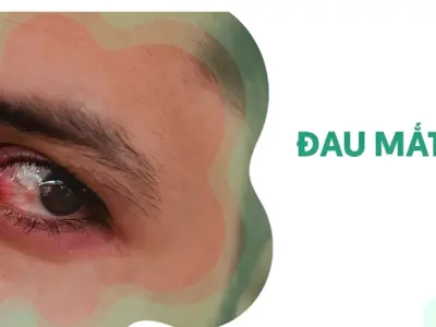 Tổng hợp hình ảnh bệnh đau mắt đỏ ở người lớn và trẻ em