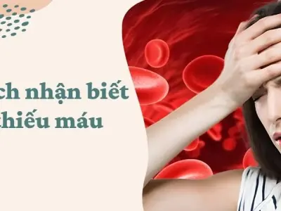 Cách nhận biết thiếu máu để phát hiện bệnh sớm nhất