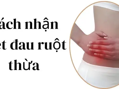 Cách nhận biết đau ruột thừa nhận ra sớm là còn cơ hội sống